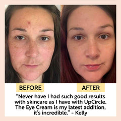 Eye Cream with Hyaluronic Acid & Coffee